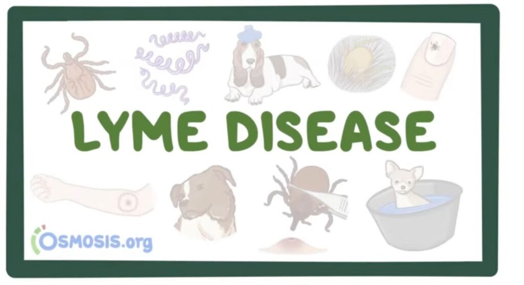 lyme disease