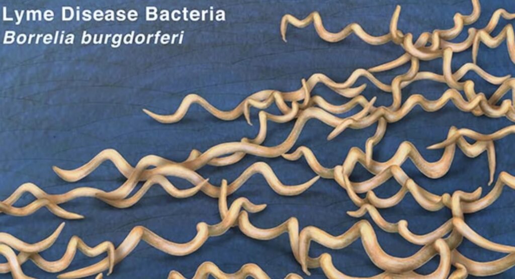 lyme disease